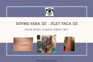 DÖVME - YARA İZİ - JİLET İZİ POLİS BEKÇİ OLMAYA ENGEL Mİ?