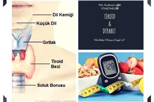TİROİD VE DİYABET POLİSLİĞE ENGEL Mİ?
