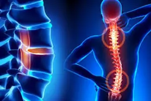 POMEM’de Skolyoz (2025): Kaç Dereceye Kadar Kabul Edilir? Polislikte Skolyozdan Elenir miyim?