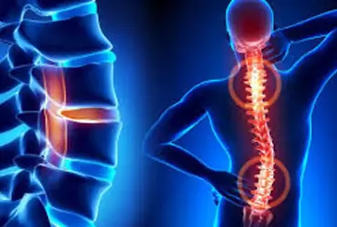 POMEM’de Skolyoz (2025): Kaç Dereceye Kadar Kabul Edilir? Polislikte Skolyozdan Elenir miyim?